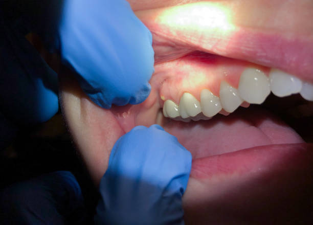 Best Emergency Cosmetic Dentistry in Marlborough, MO