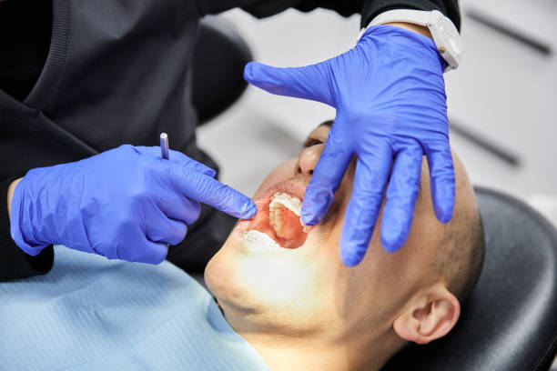 Best Emergency Dentist for Lost Fillings or Crowns in Marlborough, MO